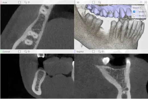 CBCT viewer